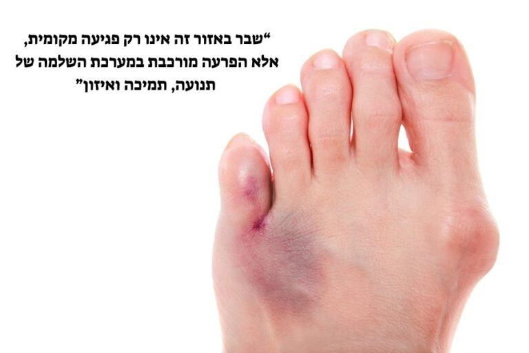 שבר באצבע ברגל – כל מה שחשוב שתדעו בנושא - אורטופד בשבילך